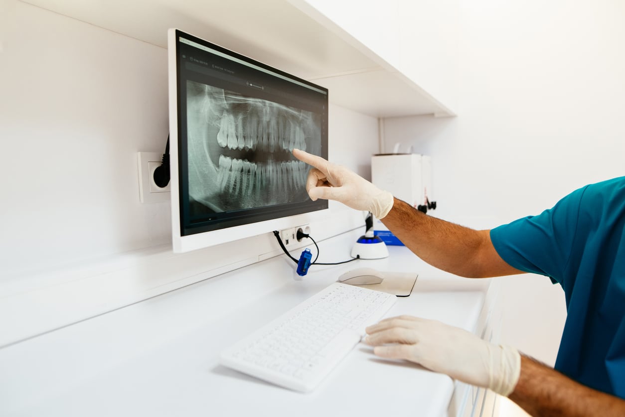 Dental professional reviewing digital x ray image at Smile By Design Orthodontics in Durango, Cortez, and Pagosa Springs, CO