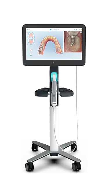 iTero digital scanner technology device at Smile By Design Orthodontics in Durango, Cortez, and Pagosa Springs, CO
